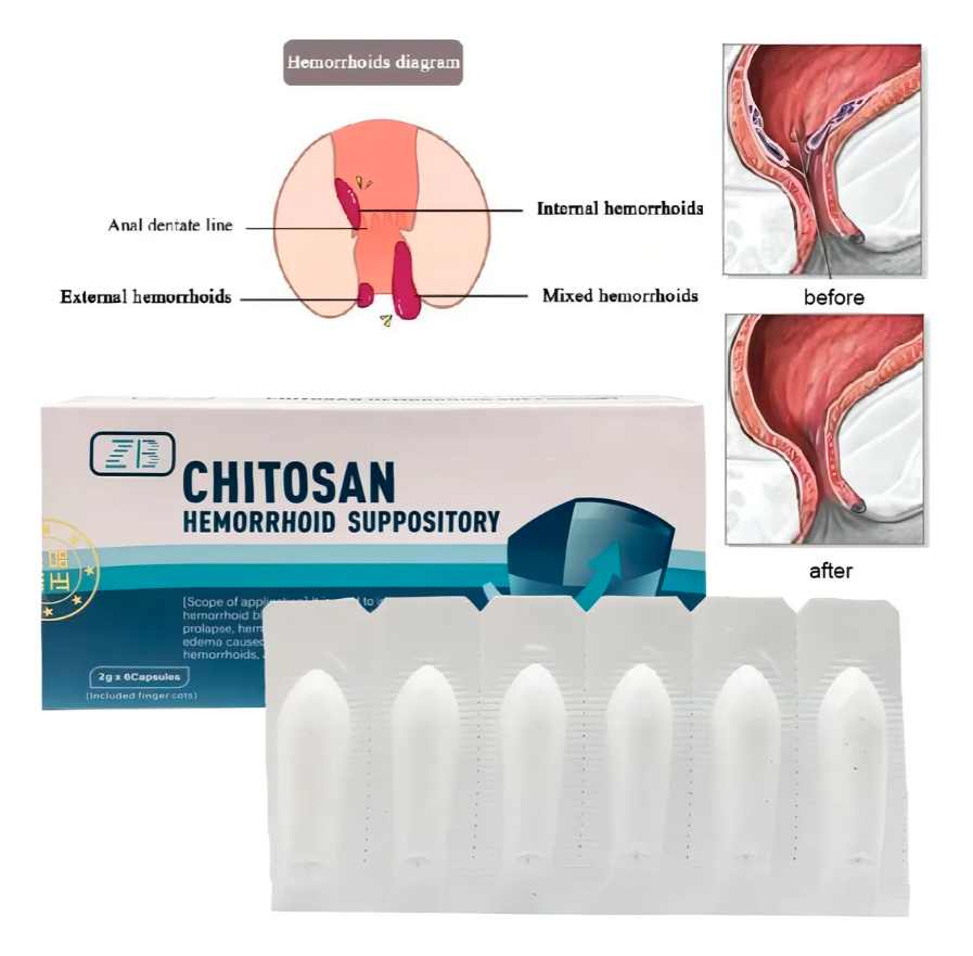 Chitosan Supositorios Para Hemorroides Sangrado 6 Unidades