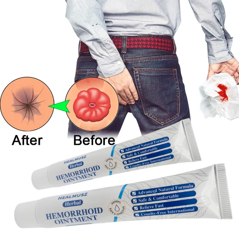 Pomada Bacteriostática Para Aliviar Dolor Anal Hemorroides